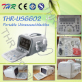 Portable Digital Ultrasound (THR-US6602)
